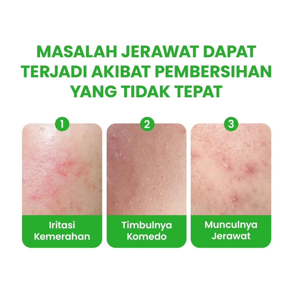 YOU Hy! Amino AC-Ttack Anti-Acne Facial Wash 50gr (Hijau)