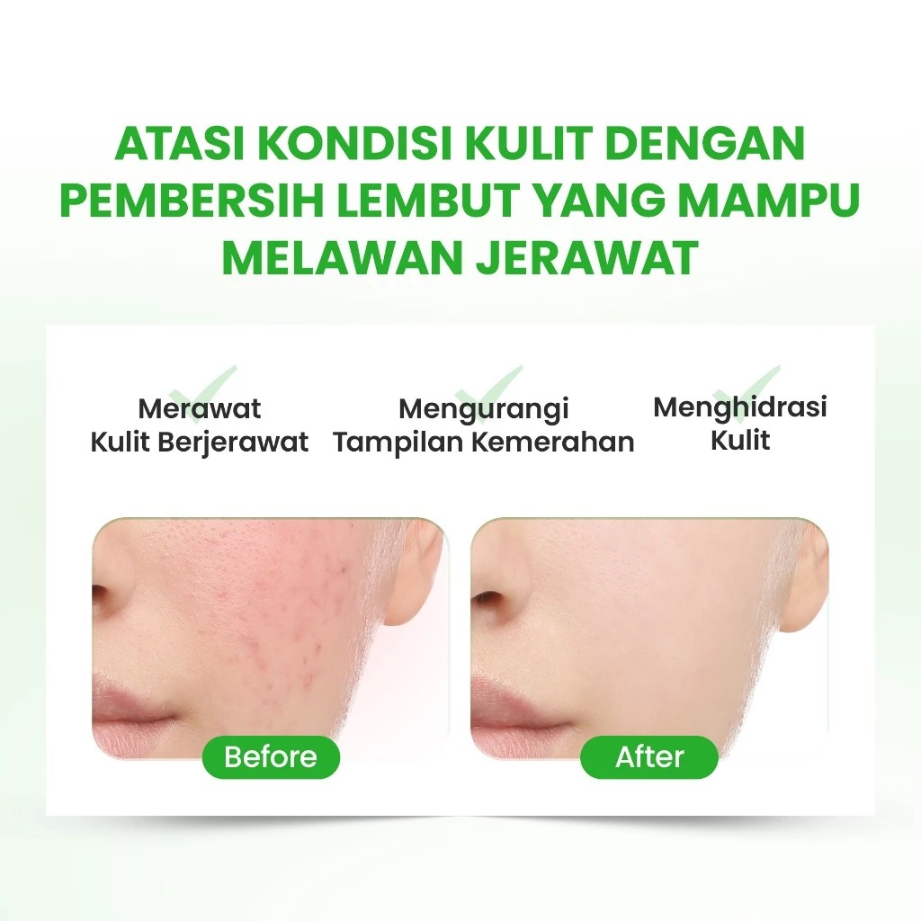 YOU Hy! Amino AC-Ttack Anti-Acne Facial Wash 50gr (Hijau)