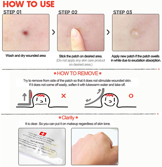 COSRX Acne Pimple Patch 24ea (Malam)