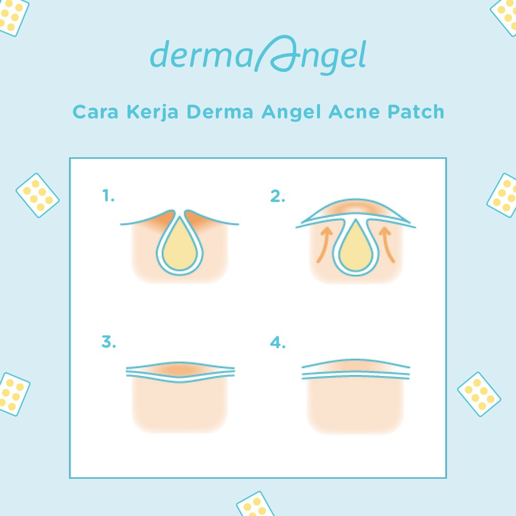 DERMA ANGEL Acne Patch Mix 18s (Day 12s Night 6s)