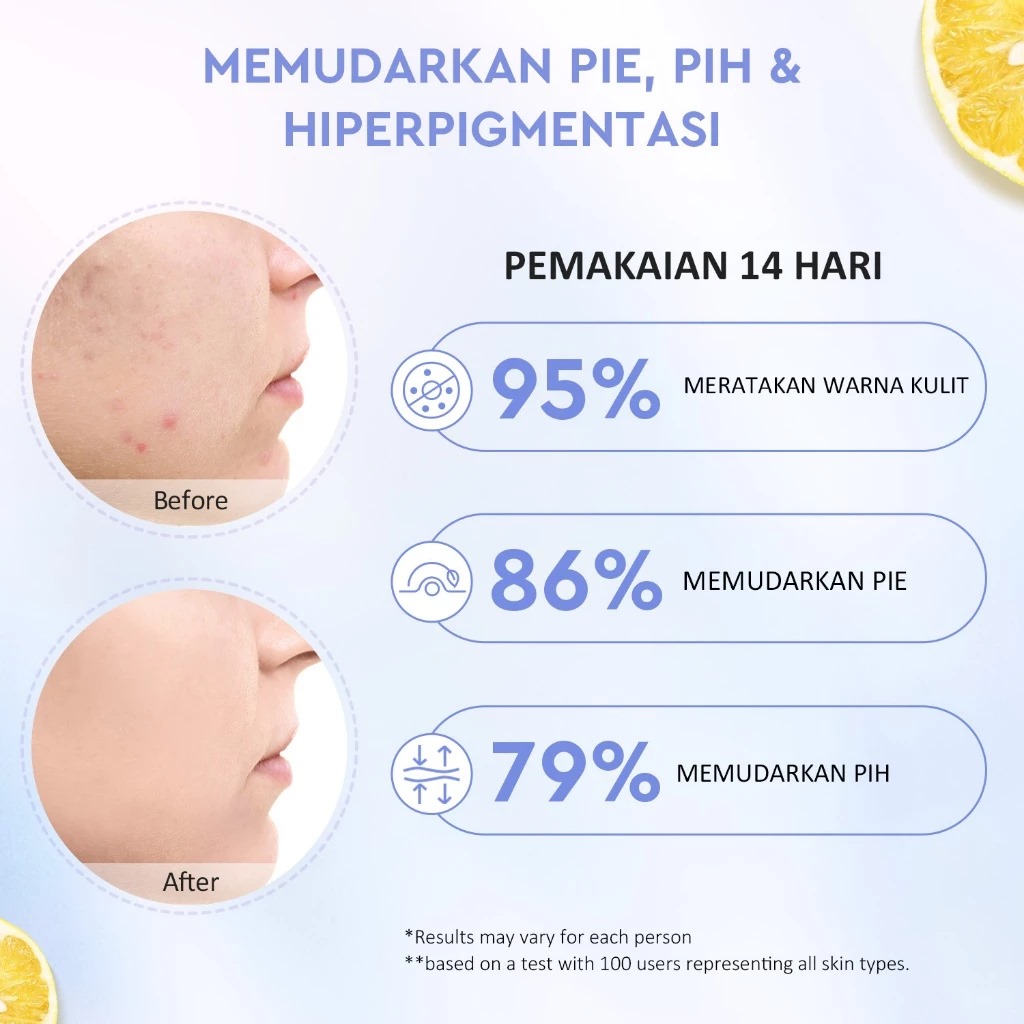 Glad 2 Glow Moisturizer - Yuja Symwhite 377 Dark Spot 100gr