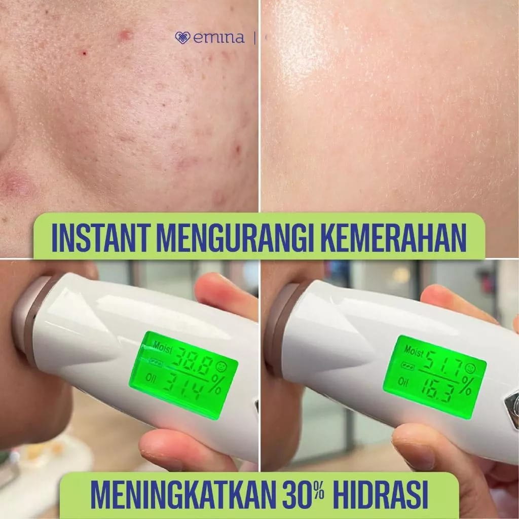 Emina Water Gel 30gr - Cica Triacid Acne Clear
