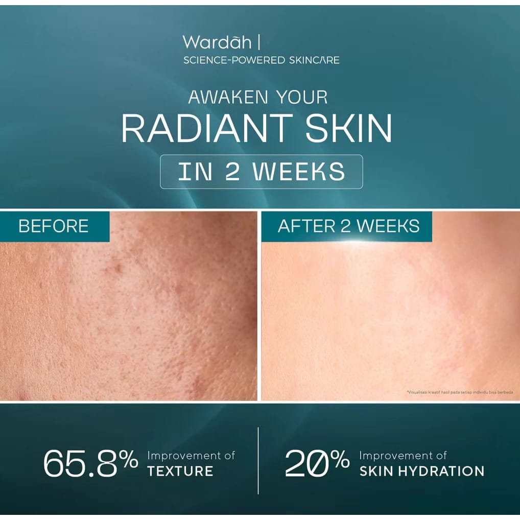 Wardah Lift Regenerating Exosome + EGF-PDRN Serum 30ml