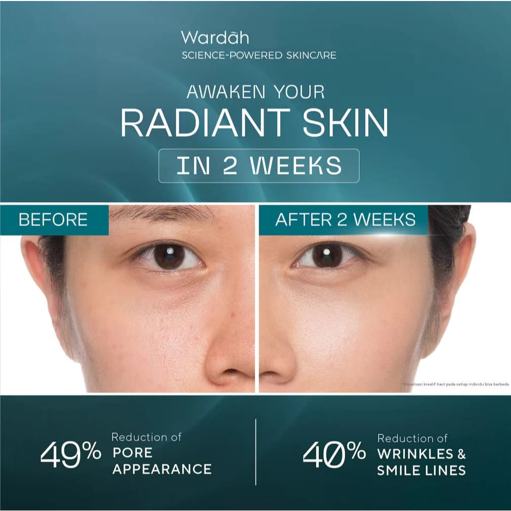 Wardah Lift Regenerating Exosome + EGF-PDRN Serum 30ml