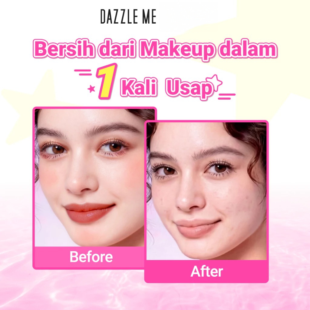 Dazzle Me Micellar Water 300ml - Brightening (Niacinamide-TXA)