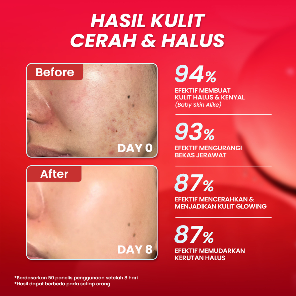 Hanasui Serum Advance Retinol Serum 20ml (Merah)