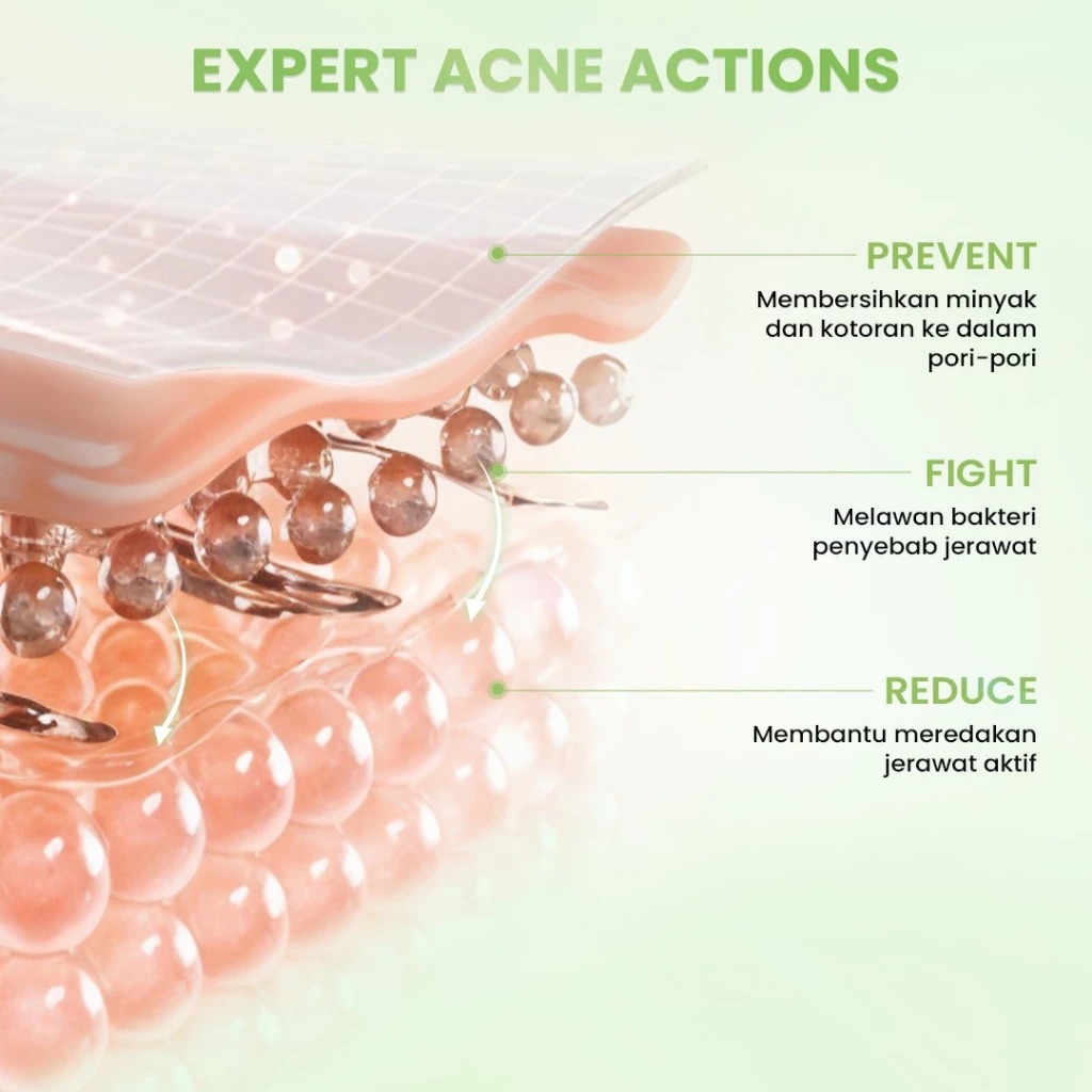 HANASUI Acne Expert Night Cream 10X Calming & Oil Balancing 15gr