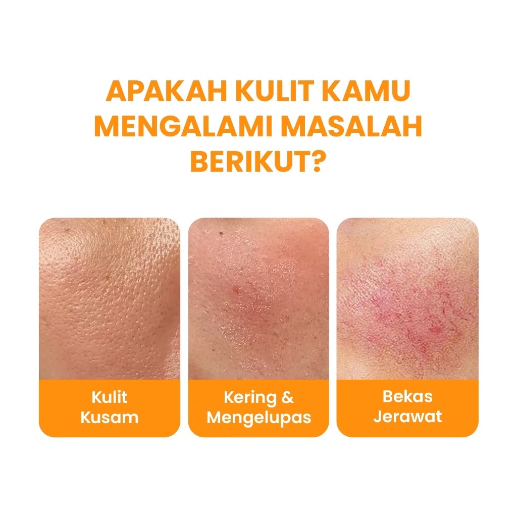 YOU Hy! Amino Glowing Gentle Cleansing Facial Wash 100gr (Orange)