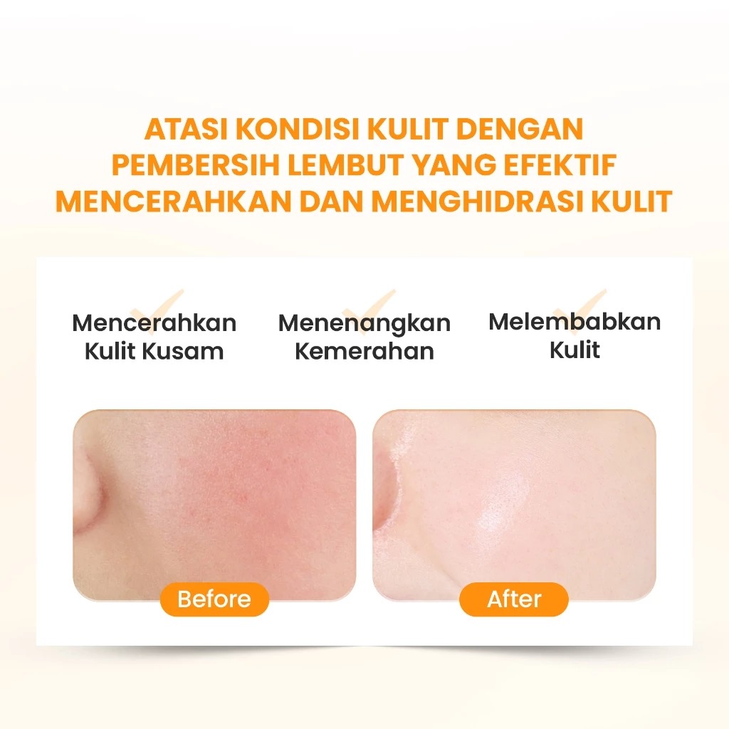 YOU Hy! Amino Glowing Gentle Cleansing Facial Wash 100gr (Orange)
