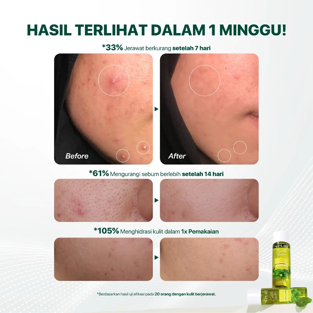 Npure Centella Face Toner 150ml