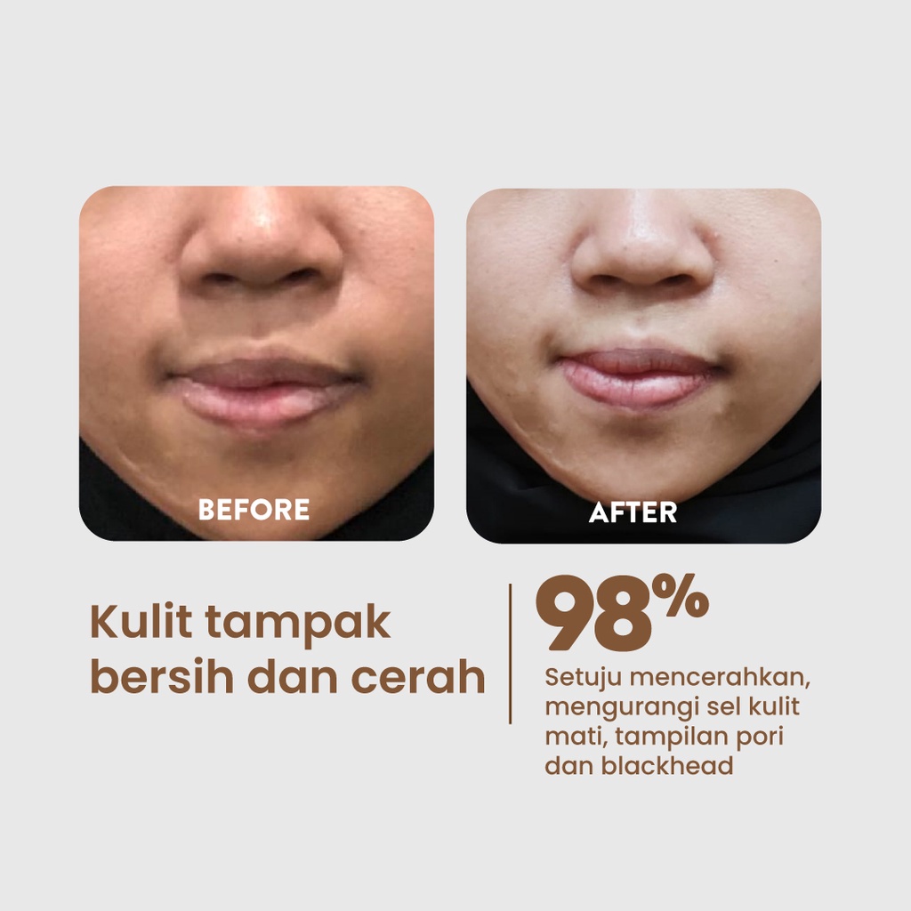Npure Licorice Milky Spotlight Toner 80ml