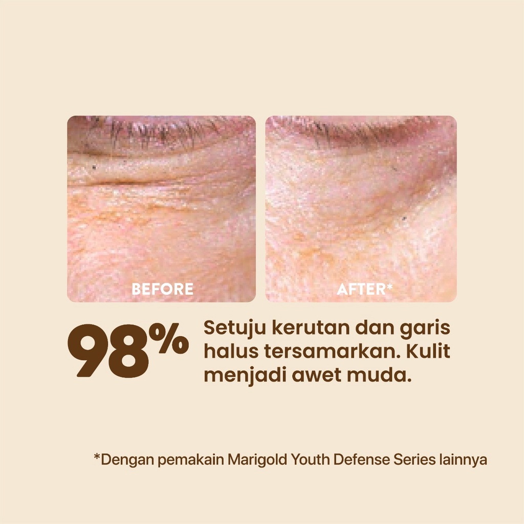 Npure Marigold Youth Revolution Treatment Face Essence Sheet Mask 28gr