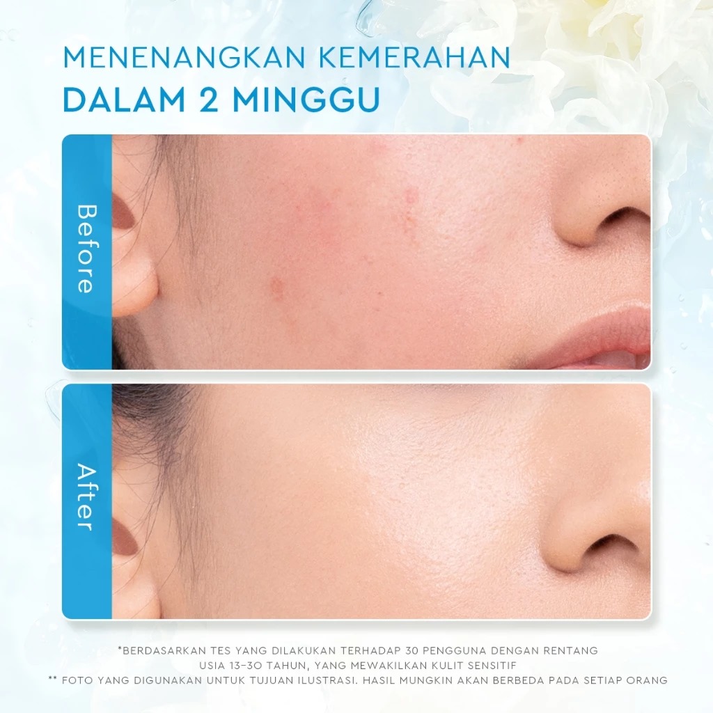 Glad 2 Glow Moisturizer - Tremella Vita B5 Sensitive Calming 30gr