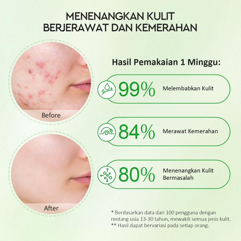 Glad 2 Glow Moisturizer - Centella Allantoin Soothing Gel 30gr
