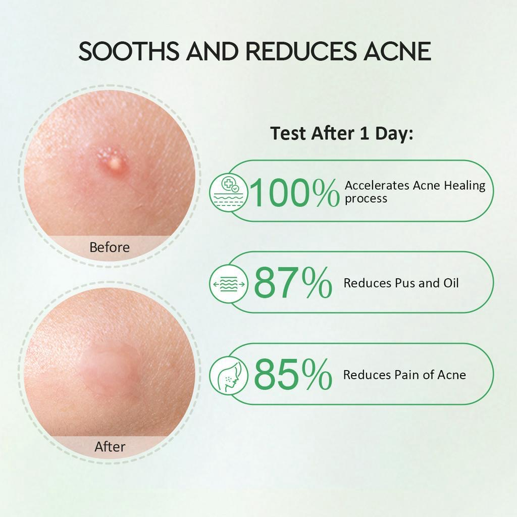 Glad 2 Glow Acne Patch - Centella Salicylic Acid Night 12patch