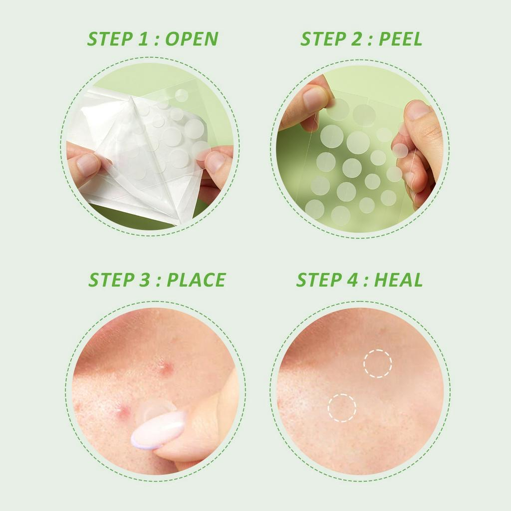 Glad 2 Glow Acne Patch - Centella Salicylic Acid Day 18patch