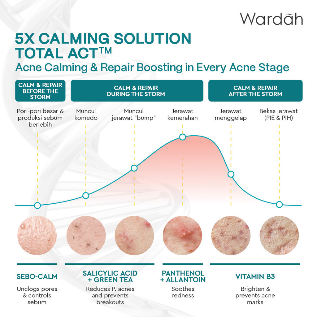 Wardah UV Shield Acne Calming Sunscreen Moisturizer SPF35 PA+++ 35ml