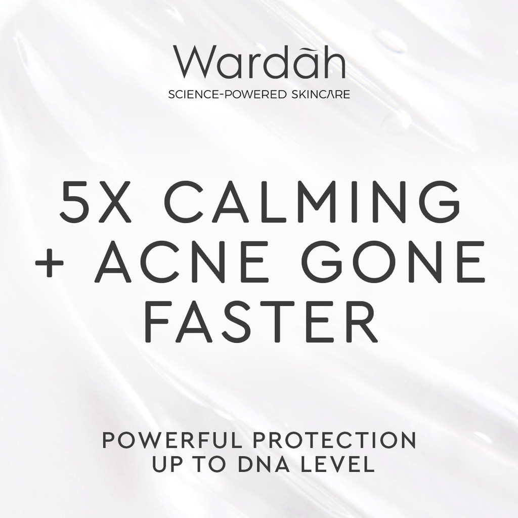 Wardah UV Shield Acne Calming Sunscreen Moisturizer SPF35 PA+++ 35ml