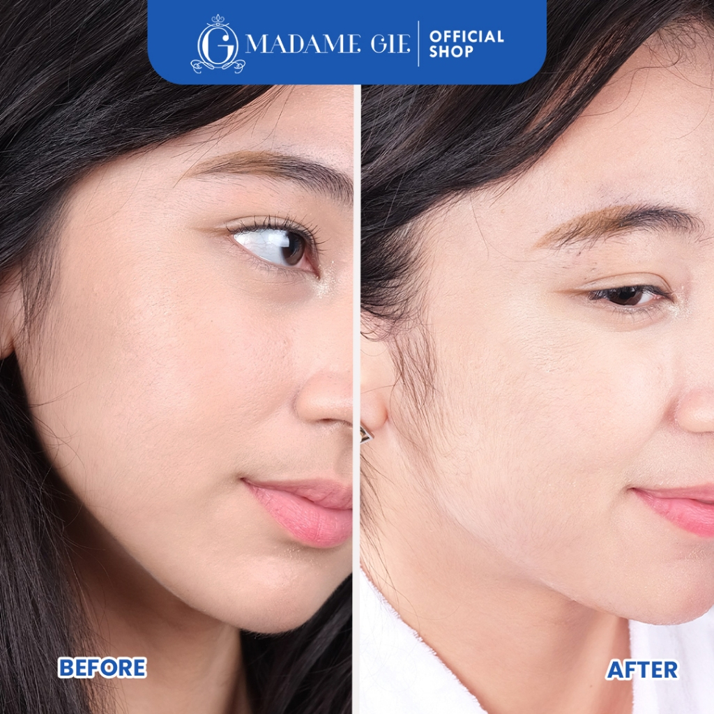 Madame Gie Necessity Sheet Mask 25ml - Panthebiome (Calm)