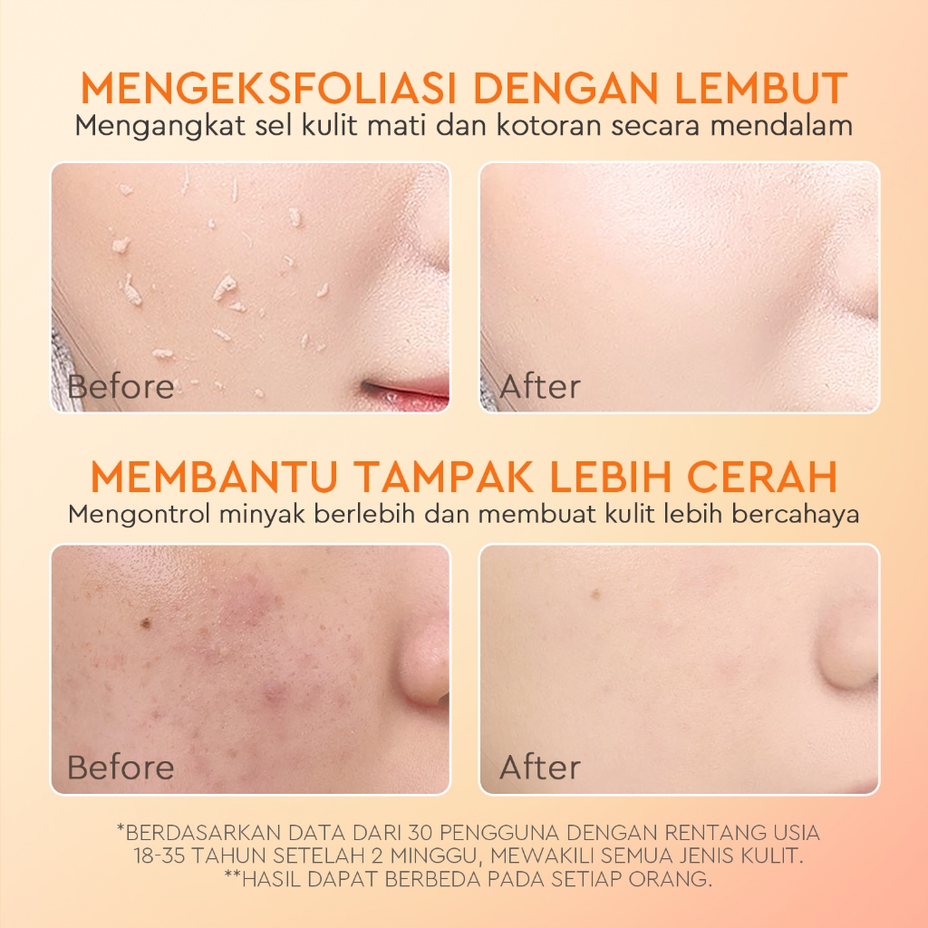 Glad 2 Glow Apricot Glycolic Acid Exfo Smooth Peeling Gel 50gr