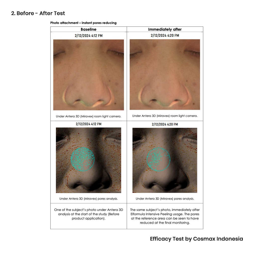 Elformula Intensive Peeling Solution 35gr