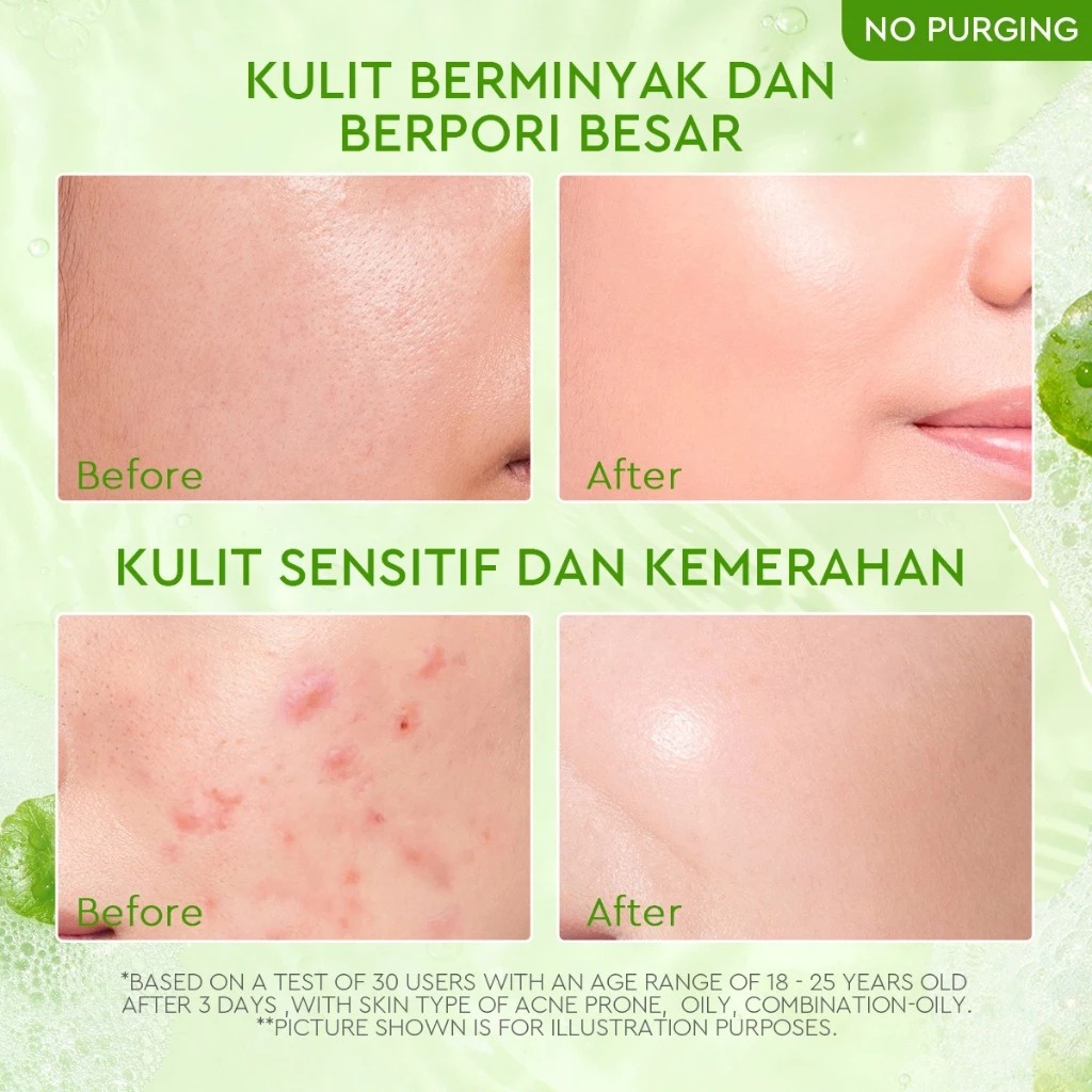 Glad 2 Glow Cleanser - Centella Salicylic Acid Acne Gel 70ml