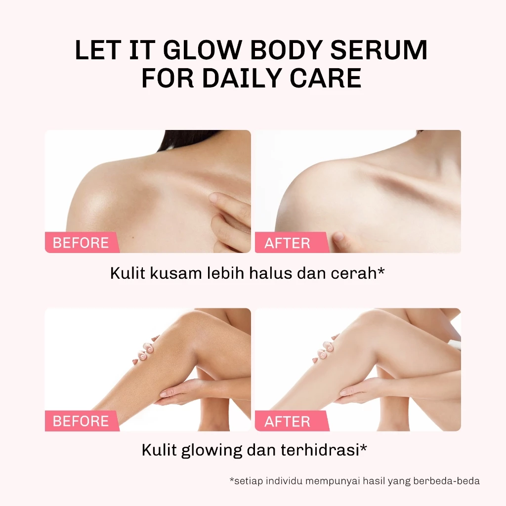 Lavojoy Let It Glow Summertain Skin Brightening Body Serum 180ml