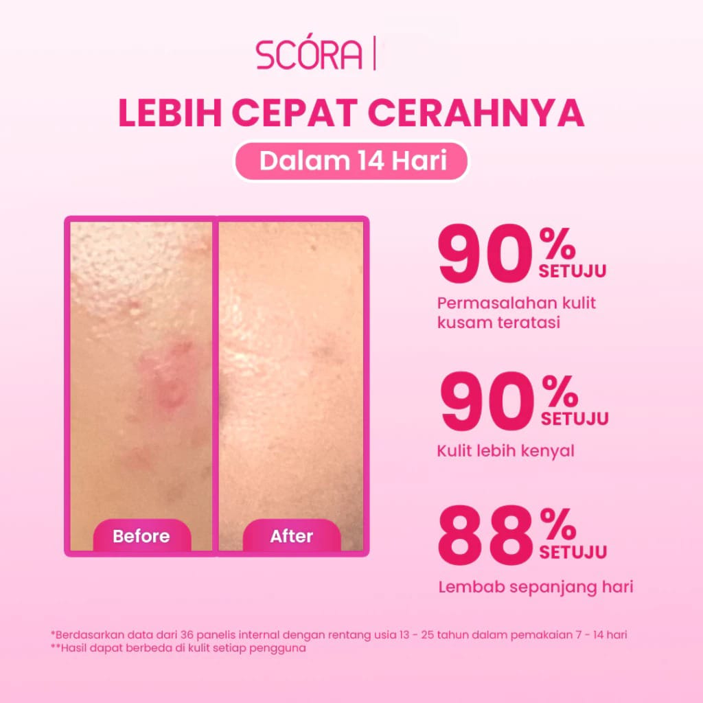 Scora 5% Niacinamide Hydramoist Gel With Alpha Arbutin & Panthenol 45ml
