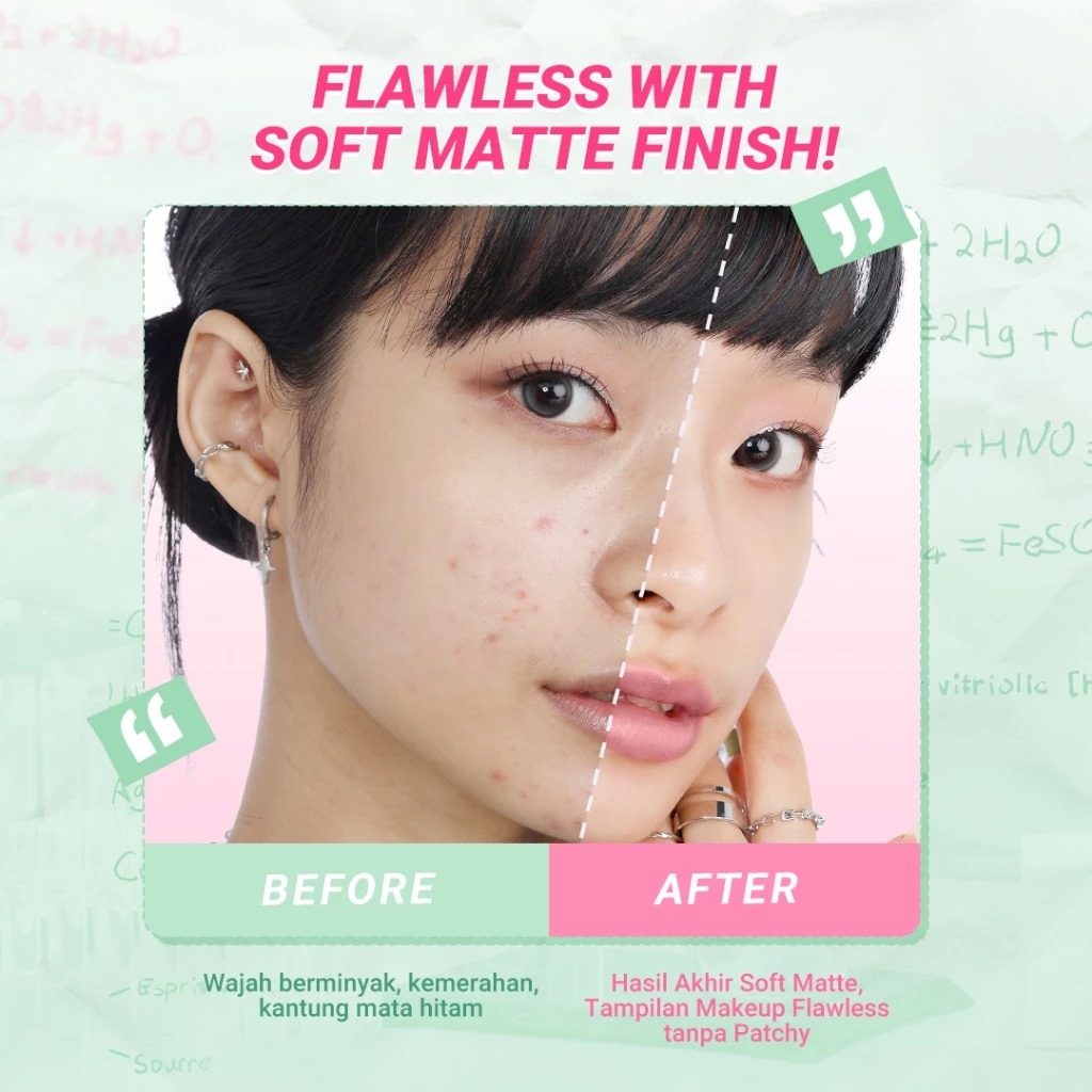 Dazzle Me Acne Armor Flawless Flex Perfection Cushion SPF35 PA+++ 13gr - C01 Light Fair