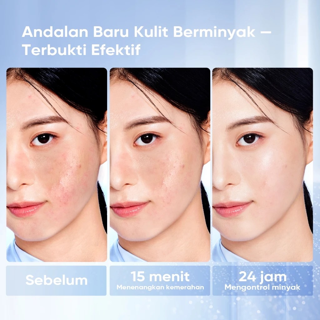 Skintific 5X Ceramide Barrier Moisture Gel - Light Texture 30gr