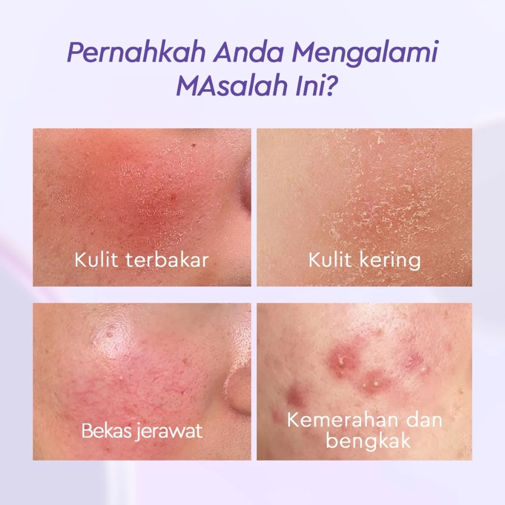 Glad 2 Glow Moisturizer - Blueberry 5% Ceramide 100gr