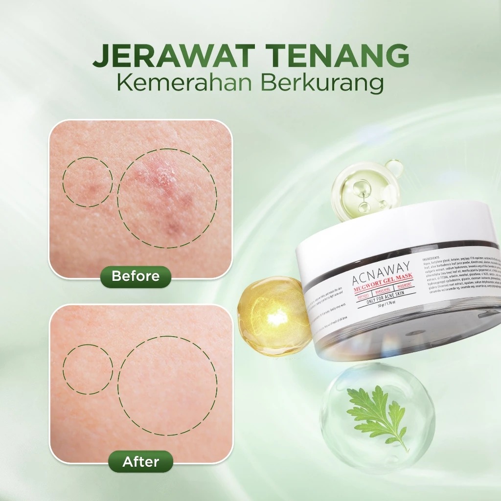 Acnaway Mugwort Gel Mask 50gr