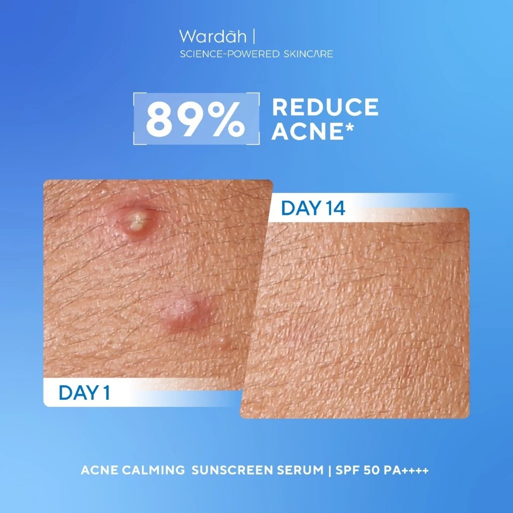 Wardah UV Shield Acne Calming Sunscreen Serum SPF50 PA++++ 100ml