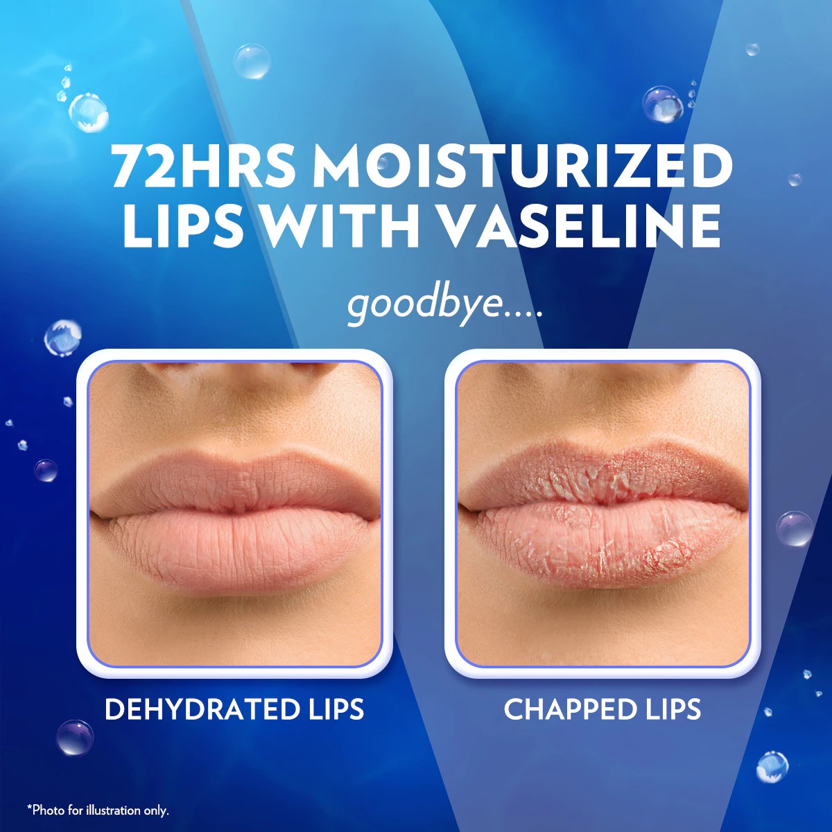Vaseline Lip Care 7gr - Original (Lip Balm Jar)