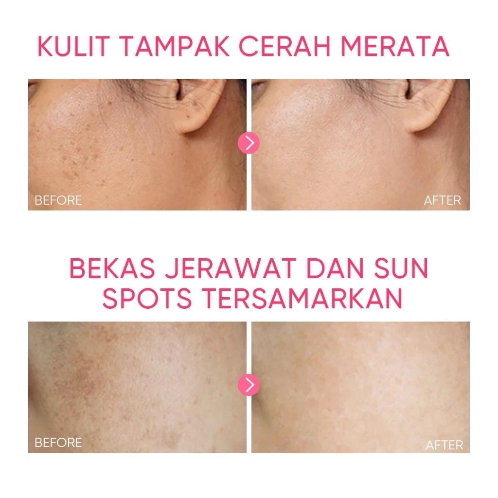 Skintific MSH Niacinamide Brightening Moisture Gel 50gr