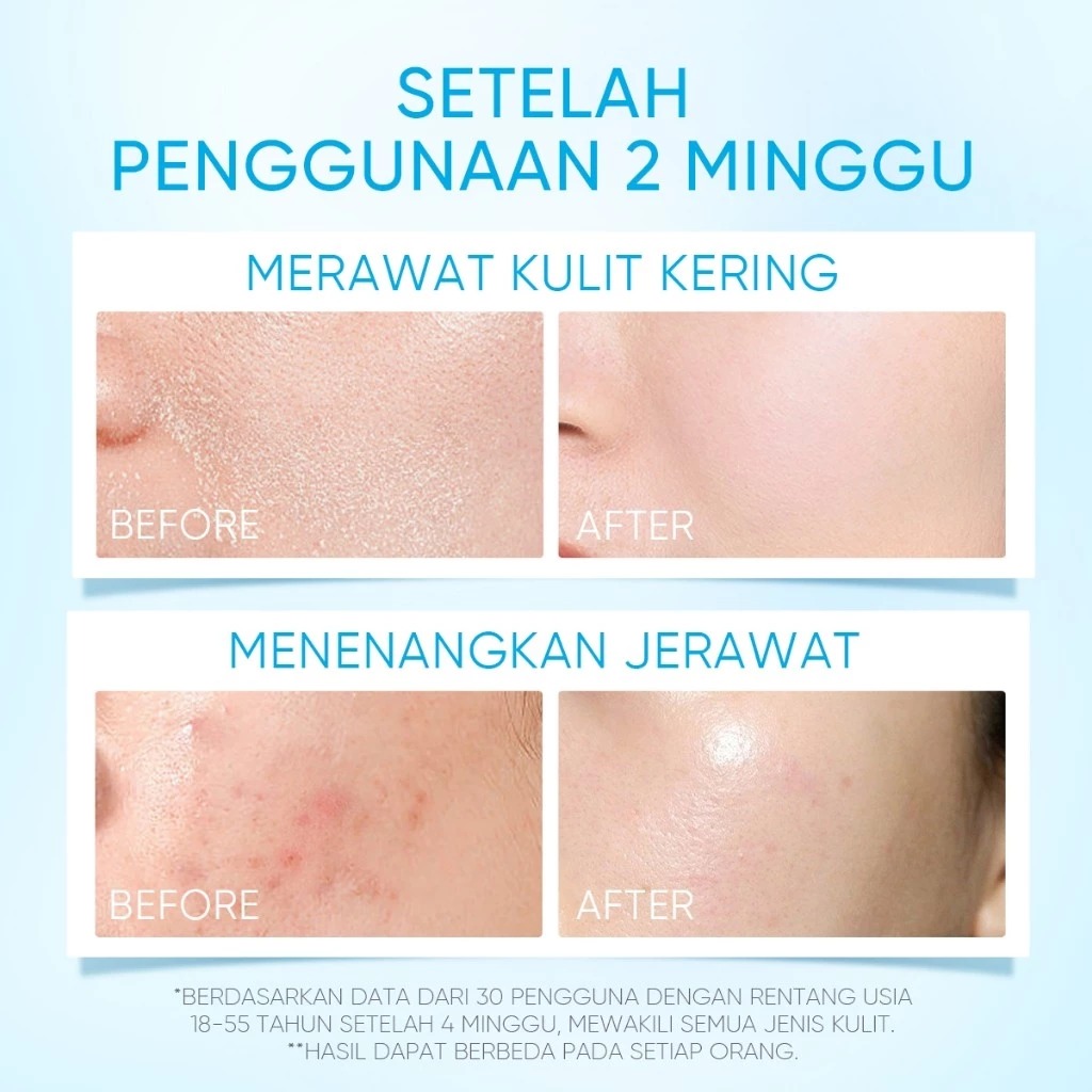 Skintific 5X Ceramide Barrier Moisture Gel 100gr