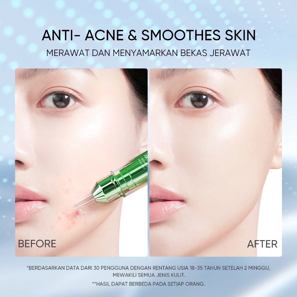 Skintific 3X Acid Intensive Acne Spot Gel 11gr