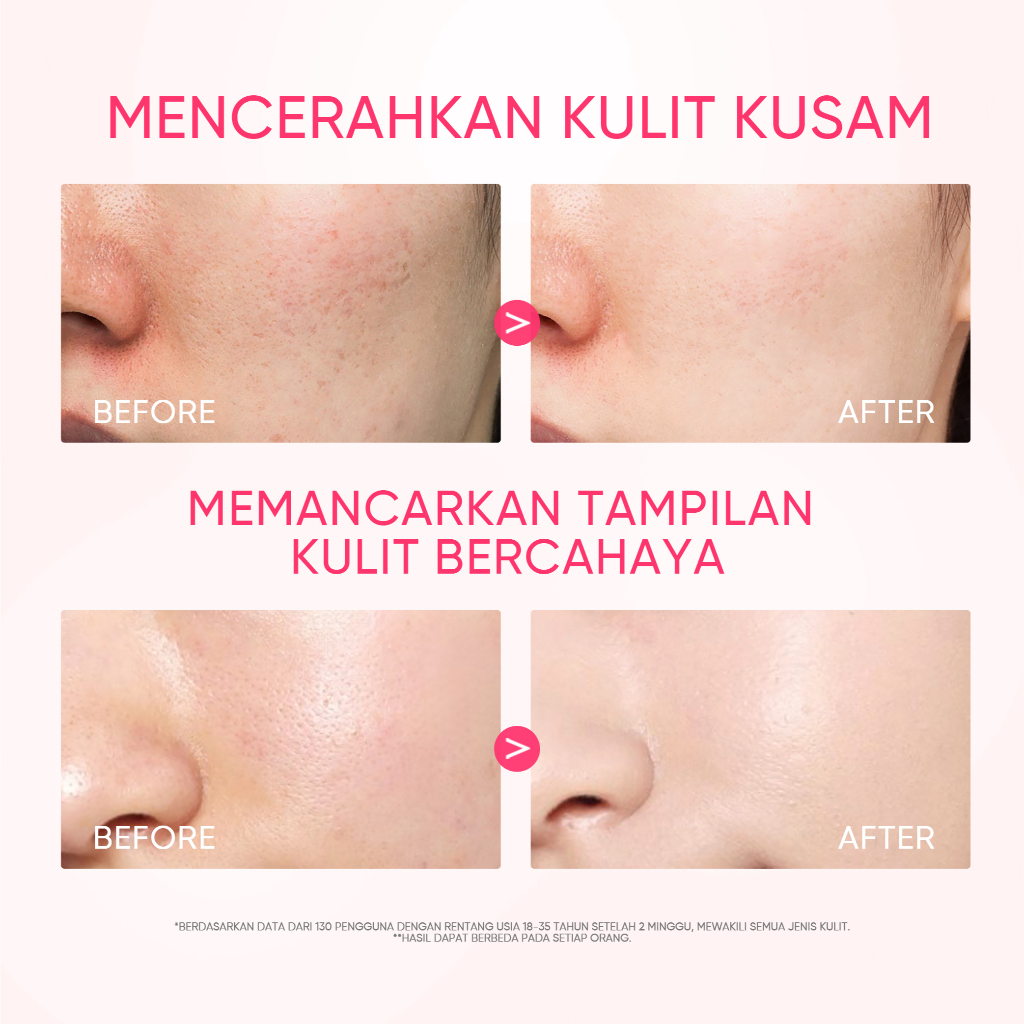 Skintific Niacinamide Brightening Essence Toner 80ml